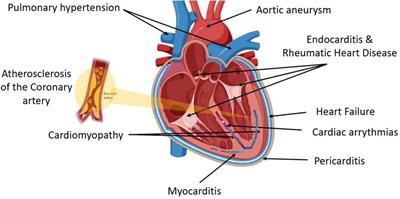 Impact of the MIF -173G/C variant on cardiovascular disease risk: a meta-analysis of 9,047 participants